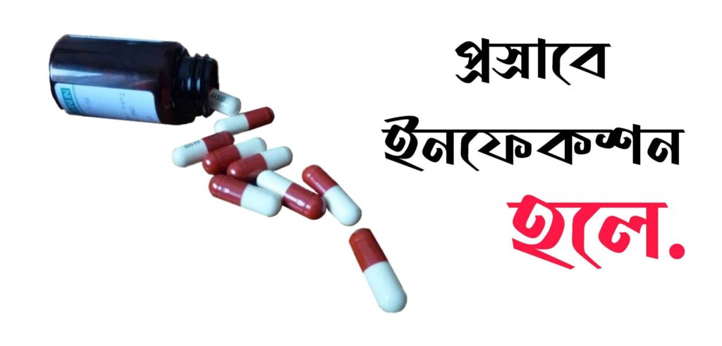 প্রস্রাবে ইনফেকশন হলে কি ঔষধ খেতে হবে?